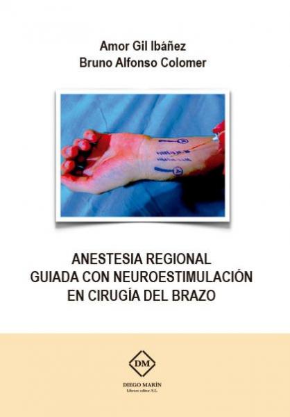 Anestesia regional guiada con neuroestimulacion en cirugia del brazo