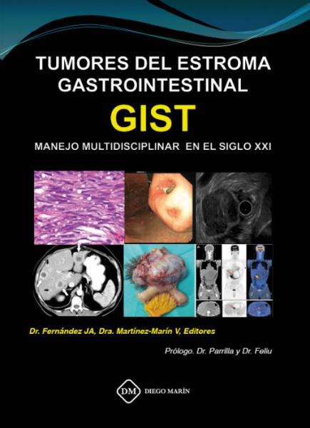 Tumores del estroma gastrointestinal gist. manejo multidisciplinar en el siglo xxi