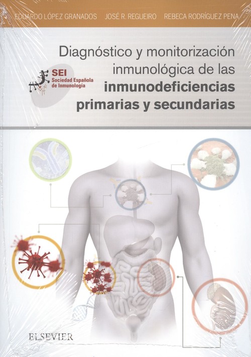 Diagnóstico y monitorización inmunológica de las inmunodeficiencias primarias y secundaria