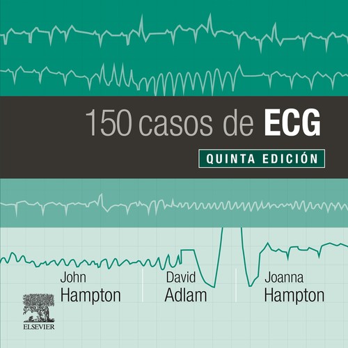 150 casos de ecg (5ª ed.)