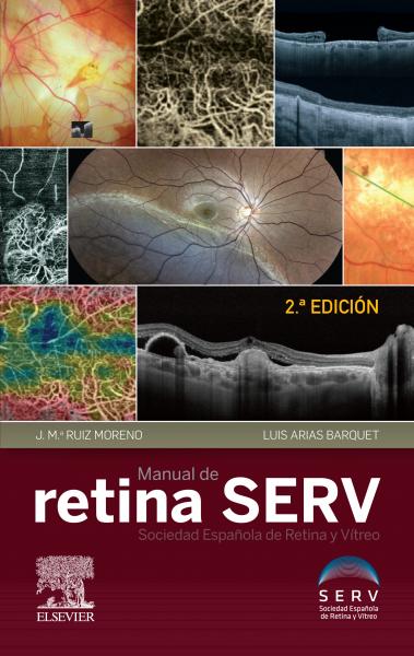 Manual de retina serv (2ª ed.)
