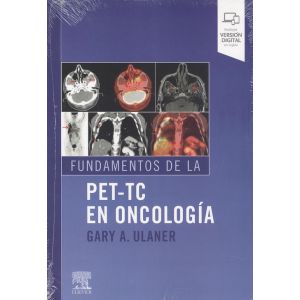 FUNDAMENTOS DE LA PET-TC EN ONCOLOGIA