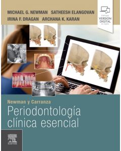 Newman y carranza. periodontología clínica esencial