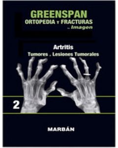 ORTOPEDIA Y FRACTURAS EN IMAGEN  ARTRITIS  TUMORES Y LESIONES TUMORALES