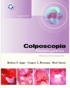 Colposcopia. principios y práctica + dvd-rom