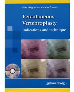 Percutaneous vertebroplasty: indications and technique (incluye cd-rom) (edición inglés)