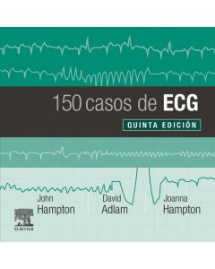 150 casos de ecg (5ª ed.)