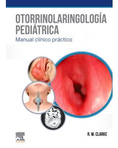 Otorrinolaringologia pediatrica